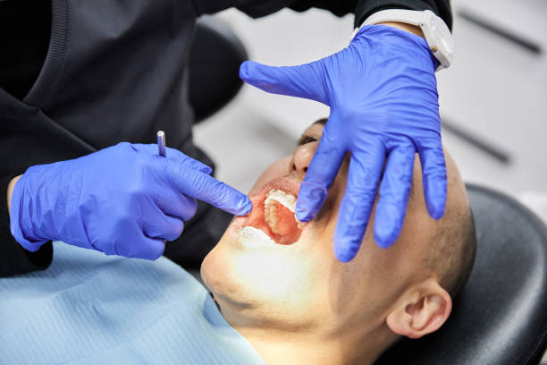 Best Emergency Tooth Extraction in Old Saybrook Center, CT