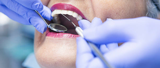Best Emergency Treatment for Dental Infections or Abscesses in Old Saybrook Center, CT